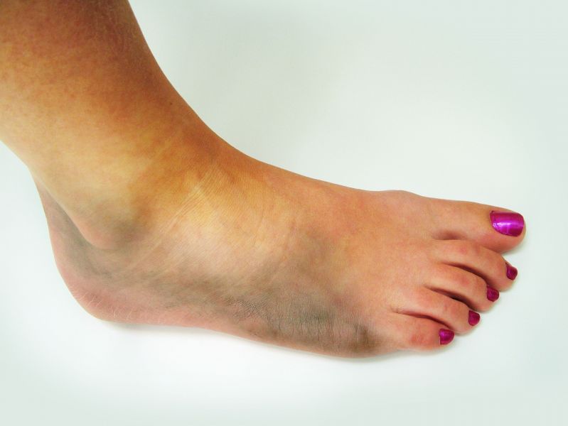 Understanding What Foot Orthotics in Kenosha, WI Can Do