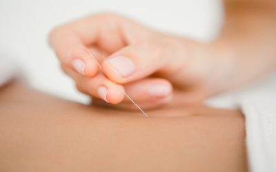 Improve Wellness and Balance Through a Local Acupuncturist, Union City, CA Approach