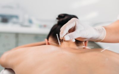 Improve chronic pain management using acupuncture therapy in Union City, CA, with local experts.