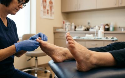 Guidance for Managing Ingrown Toenails With Care in Concord, CA